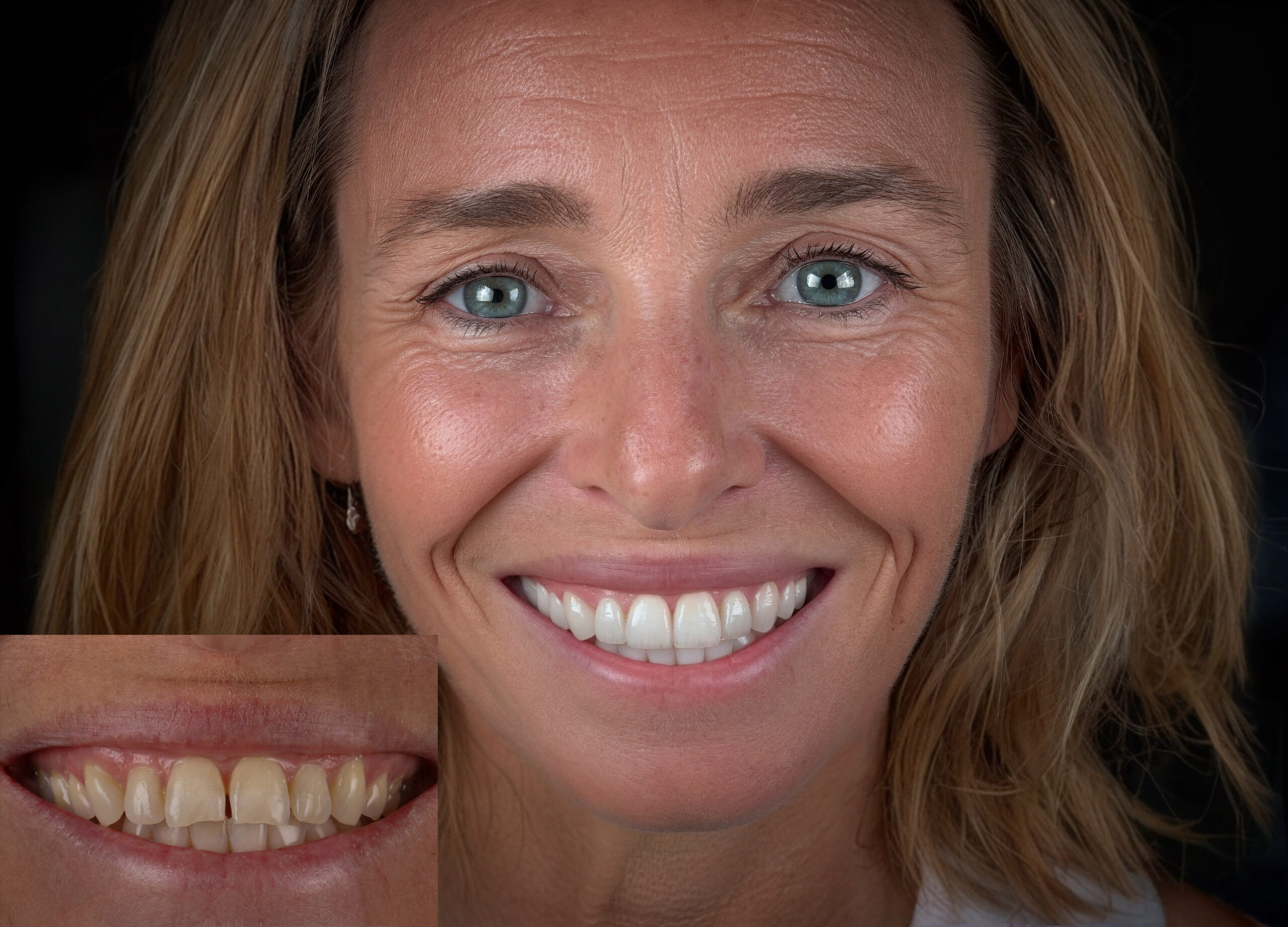 SMILE MAKEOVER