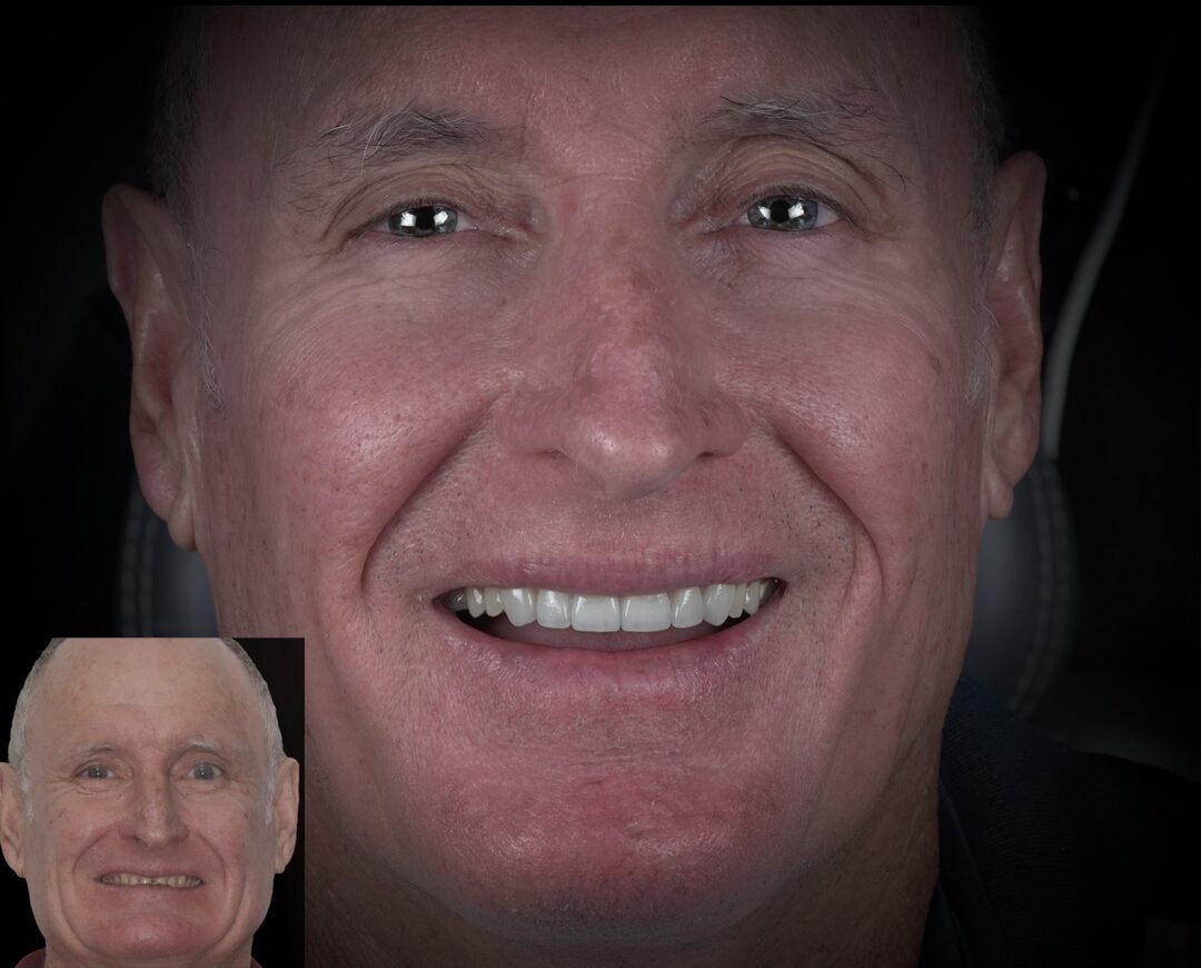 SMILE MAKEOVER